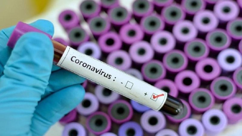 12 إصابة جديدة بفيروس كورونا في الدوير