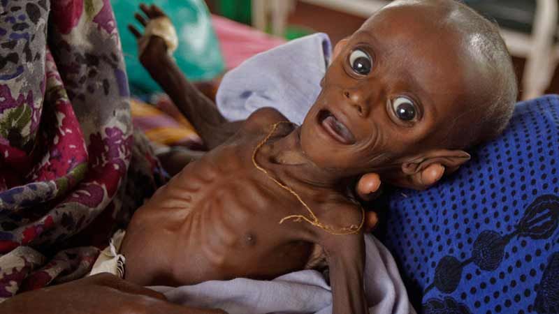 الاتحاد الأوروبي: 10 ملايين يمني على شفير المجاعة