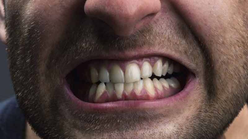 الإجهاد يؤثر على صحّة أسنانكم