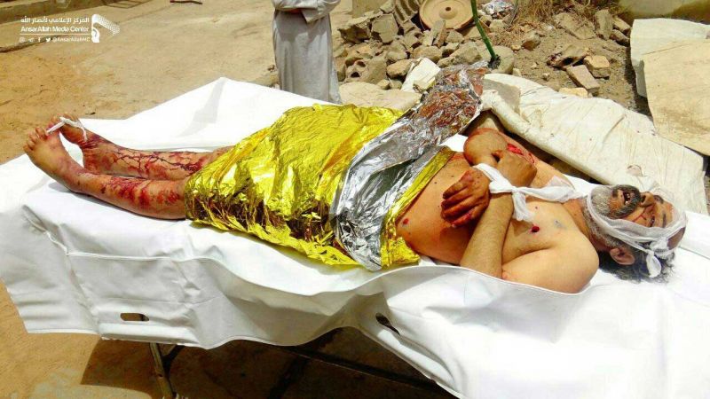 استشهاد 7 مواطنين يمنيين بينهم أطفال بغارة سعودية على مستشفى في صعدة