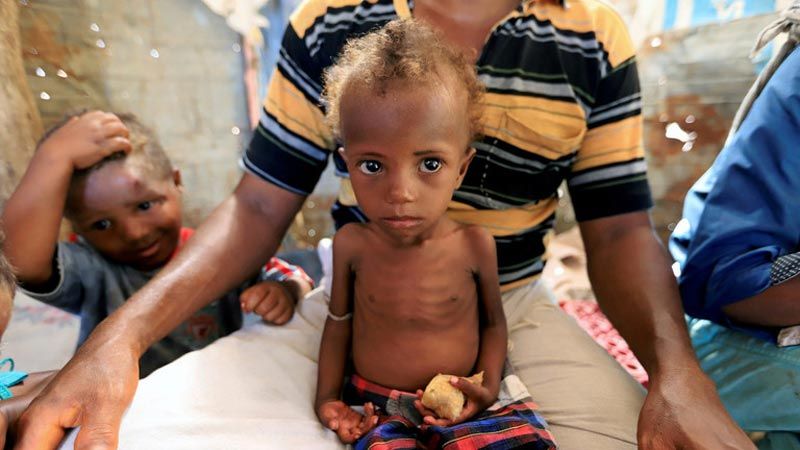 10 ملايين يمني على بُعد خطوة من المجاعة