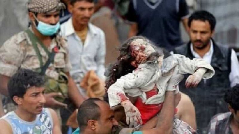 وزارة حقوق الإنسان اليمنية: العدوان قتل 3 آلاف و747 طفلاً وجرح 4 آلاف آخرين