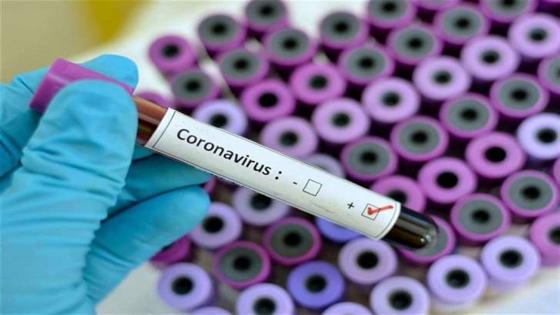 الصحة الايرانية: 6420 إصابة جديدة و79 حالة وفاة بفيروس كورونا