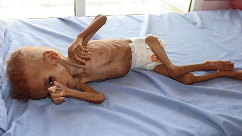"الجحيم على الأرض".. اليمن يُواجه أكبر مجاعة في التاريخ الحديث