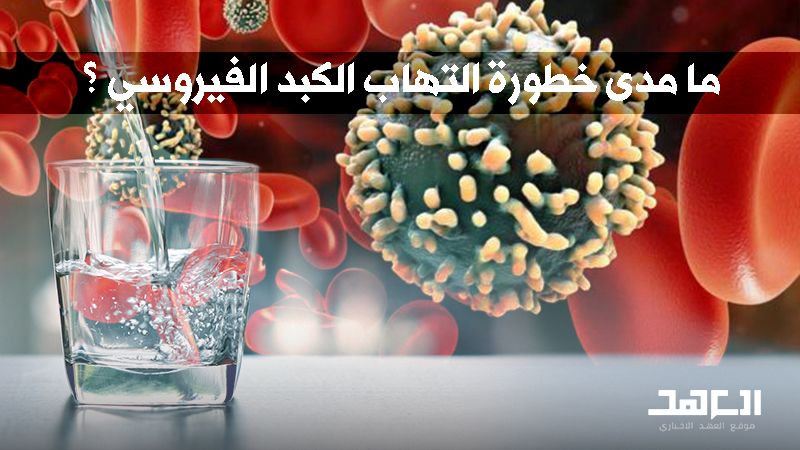 فيروس &quot;Hepatite-A&quot; في لبنان.. لا داعي للقلق والحماية بالنظافة