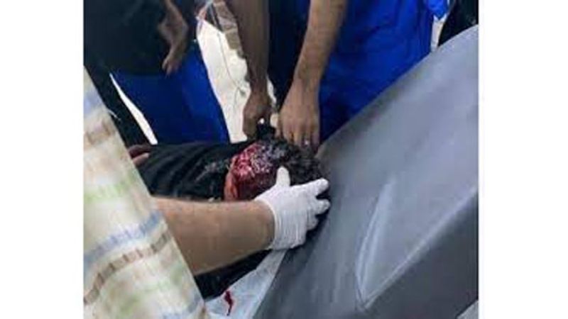 إصابة طفل فلسطيني في رأسه خلال مواجهات مع الاحتلال عند مدخل قرية النبي صالح
