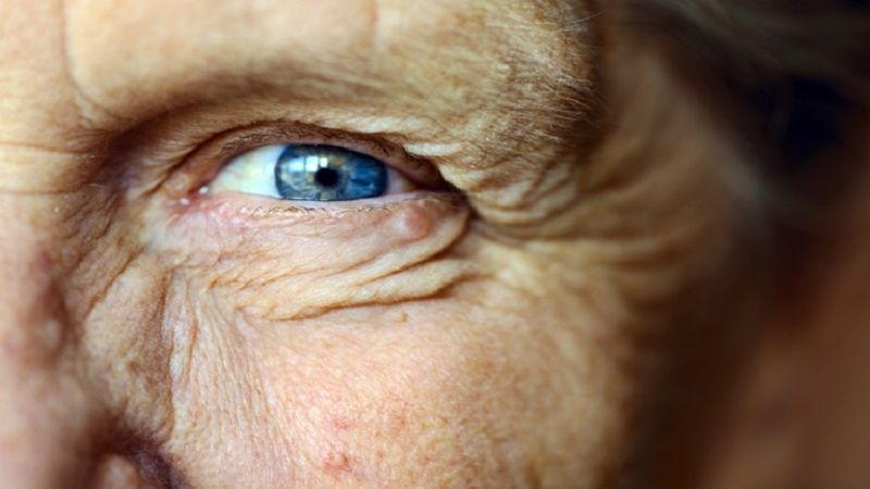 "الغلوكوما" يهدّد كبار السن بالعمى دون أن يدركوا ذلك