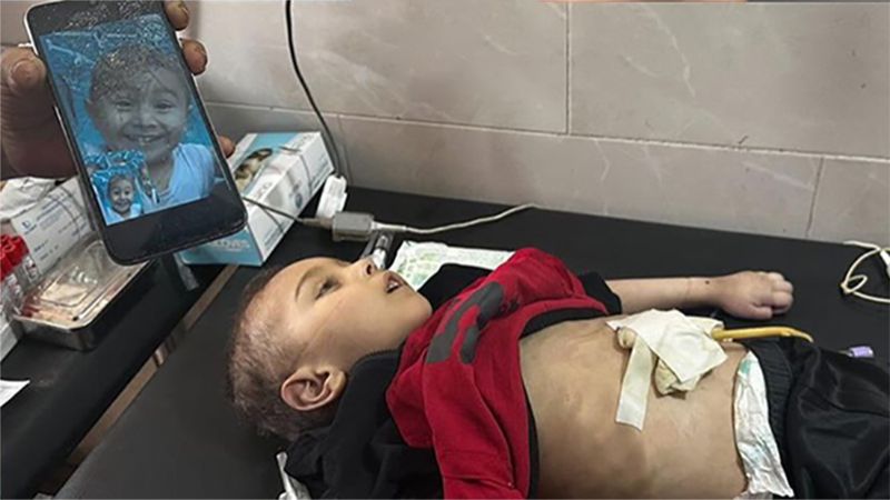 فلسطين: استشهاد طفل من شمال غزة بسبب سوء التغذية والمجاعة واستمرار حصار الاحتلال لمدينة غزة وشماله